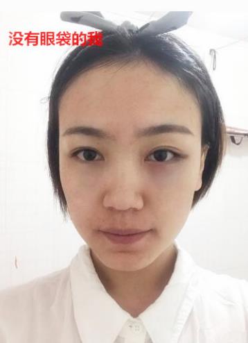 衛(wèi)婭日記：我一直都以為眼袋對(duì)我的影響只是美觀，直到我了解了以后……