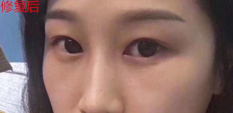 衛(wèi)婭日記：我一直都以為眼袋對(duì)我的影響只是美觀，直到我了解了以后……