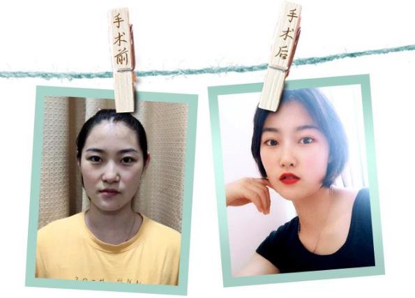 深圳恒妍整形技術(shù)如何 幫助廣大女性解決多重肌膚問(wèn)題