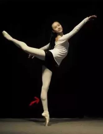 上海麗質(zhì)美學(xué)整形門(mén)診部做瘦小腿價(jià)格貴嗎？肌肉小腿太難減怎么辦