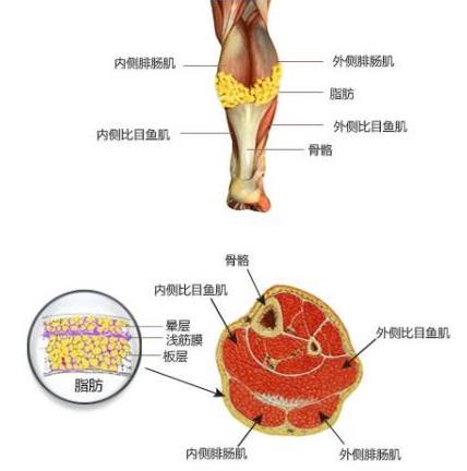 上海麗質(zhì)美學(xué)整形門(mén)診部做瘦小腿價(jià)格貴嗎？肌肉小腿太難減怎么辦
