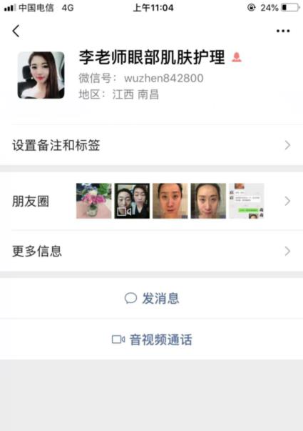 君雅筆記：眼袋過(guò)重，就會(huì)顯得比真實(shí)年齡大，要如何修復(fù)眼袋呢？