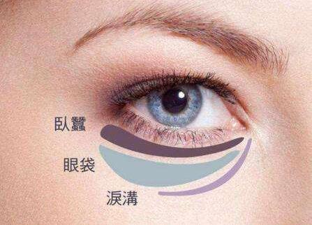 八大處整形楊欣幫你講解：眼袋祛除后過幾年還會(huì)復(fù)發(fā)嗎？