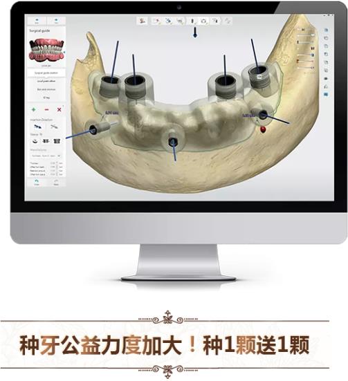 中家醫(yī)口腔全民愛(ài)牙公益行動(dòng)：德國(guó)智能種植牙更靠譜
