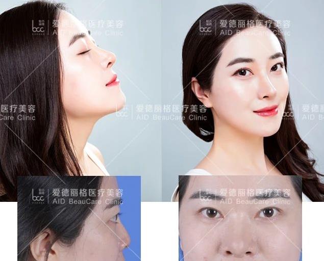大連愛德麗格“你好美鼻”免費(fèi)鼻部模特招募活動完美落幕