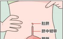 ?肚臍下面疼是怎么回事，肚臍下面疼是怎么回事男性